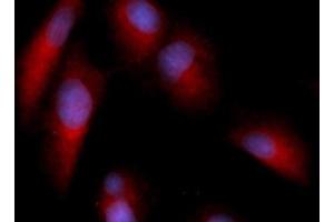 Immunofluorescence (IF) image for anti-Annexin A5 (ANXA5) (AA 1-320) antibody (PE) (ABIN5564838) (Annexin V antibody  (AA 1-320) (PE))