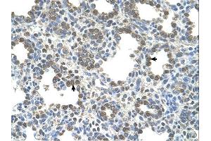 SLC26A5 antibody was used for immunohistochemistry at a concentration of 4-8 ug/ml. (SLC26A5 antibody)
