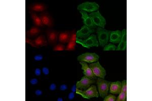 ABIN6255078 and ABIN6267287 staining H2O2 treated Hela cells by IF/ICC.