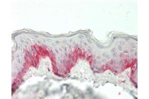 Human Skin: Formalin-Fixed, Paraffin-Embedded (FFPE). (FGF23 antibody  (AA 79-160) (Biotin))