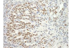 Immunohistochemistry (IHC) image for anti-Splicing Factor 3b, Subunit 3, 130kDa (SF3B3) (AA 1167-1217) antibody (ABIN7448792)