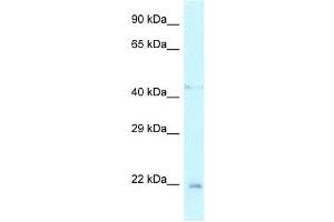 Western Blot showing Twist1 antibody used at a concentration of 1. (TWIST1 antibody  (N-Term))