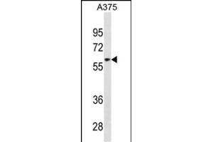 ZN Antibody (Center) (ABIN1882024 and ABIN2838879) western blot analysis in  cell line lysates (35 μg/lane). (ZNF394 antibody  (AA 287-316))