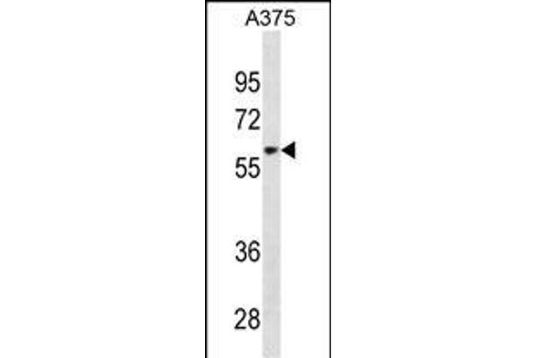 ZNF394 Antikörper  (AA 287-316)