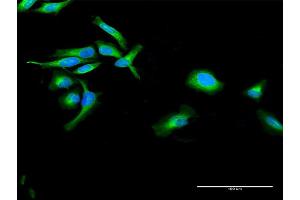 Immunofluorescence of purified MaxPab antibody to POR on HeLa cell. (POR antibody  (AA 1-680))