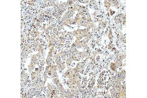 IHC analysis of MTHFD1L using anti-MTHFD1L antibody (ABIN7601728). (MTHFD1L antibody  (AA 43-833))