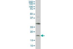 LMO2 monoclonal antibody (M01), clone 6B8 Western Blot analysis of LMO2 expression in HL-60 . (LMO2 antibody  (AA 1-158))