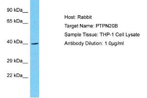 Host: Rabbit Target Name: PTPN20B Sample Type: THP-1 Whole Cell lysates Antibody Dilution: 1. (PTPN20 antibody  (N-Term))