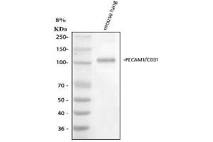 Western blot analysis of CD31 using anti-CD31 antibody (ABIN5692990).
