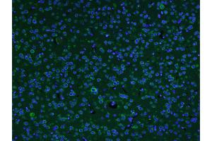 Paraformaldehyde-fixed, paraffin embedded Mouse brain Antigen retrieval by boiling in sodium citrate buffer (pH6. (AKAP12 antibody  (AA 701-900))