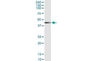 Immunoprecipitation of IL12RB1 transfected lysate using anti-IL12RB1 MaxPab rabbit polyclonal antibody and Protein A Magnetic Bead , and immunoblotted with IL12RB1 MaxPab mouse polyclonal antibody (B02) . (IL12RB1 antibody  (AA 1-381))