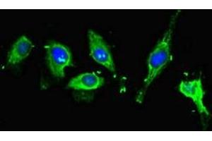 Immunofluorescent analysis of Hela cells using ABIN7160996 at dilution of 1:100 and Alexa Fluor 488-congugated AffiniPure Goat Anti-Rabbit IgG(H+L) (ME1 antibody  (AA 161-519))