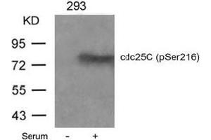 Image no. 3 for anti-Cell Division Cycle 25 Homolog C (S. Pombe) (CDC25C) (pSer216) antibody (ABIN196818) (CDC25C antibody  (pSer216))