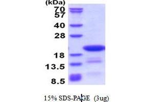 SDS-PAGE (SDS) image for Chromosome 14 Open Reading Frame 126 (C14orf126) (AA 1-168) protein (His tag) (ABIN5853477)