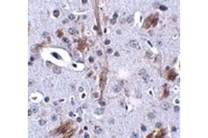 Immunohistochemistry of TTBK1 in mouse brain tissue with this product at 2. (TTBK1 antibody  (C-Term))