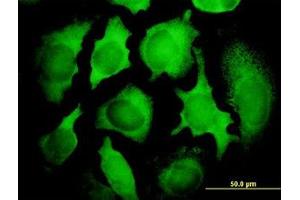 Image no. 3 for anti-PCNA Clamp Associated Factor (PAF) (AA 1-112) antibody (ABIN599096) (KIAA0101 antibody  (AA 1-112))