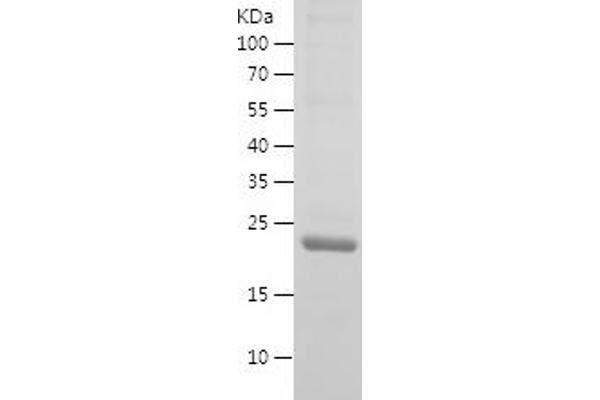 GPI Protein (AA 357-558) (His tag)