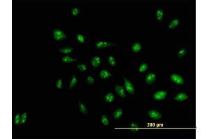 Immunofluorescence of purified MaxPab antibody to D21S2056E on HeLa cell.