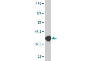 Western Blot detection against Immunogen (38. (CXCL5 antibody  (AA 1-114))