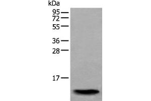 Western blot analysis of Human normal stomach tissue lysate using SAA4 Polyclonal Antibody at dilution of 1:350 (SAA4 antibody)