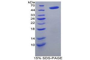SDS-PAGE (SDS) image for Thymidine Phosphorylase (TYMP) (AA 33-290) protein (His tag,GST tag) (ABIN1878874)