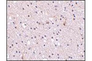 Immunohistochemistry of Nicastrin in human brain tissue with this product at 2. (Nicastrin antibody  (Center))