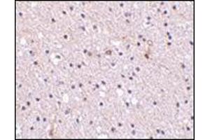 Immunohistochemistry of Nicastrin in human brain tissue with this product at 2.