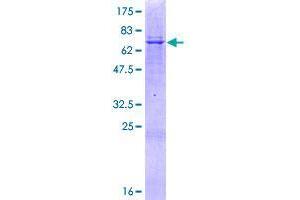 Image no. 1 for Abhydrolase Domain Containing 16B (ABHD16B) (AA 1-392) protein (GST tag) (ABIN1347410) (ABHD16B Protein (AA 1-392) (GST tag))