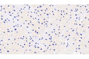 Detection of FKBP1A in Human Cardiac Muscle Tissue using Monoclonal Antibody to FK506 Binding Protein 1A (FKBP1A) (FKBP1A antibody  (AA 2-108))