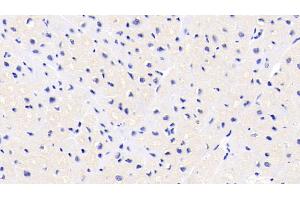 Detection of FKBP1A in Human Cardiac Muscle Tissue using Monoclonal Antibody to FK506 Binding Protein 1A (FKBP1A) (FKBP1A antibody  (AA 2-108))