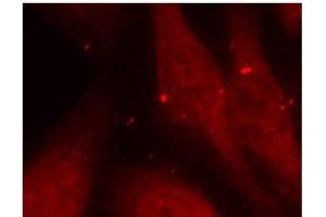 Immunofluorescence analysis of methanol-fixed HeLa cells using Phospho-ABL1(Y412) Polyclonal Antibody (ABL1 antibody  (pTyr412))