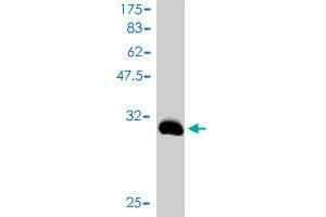 Western Blot detection against Immunogen (31. (TNP1 antibody  (AA 1-55))