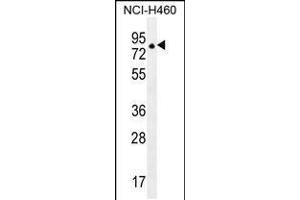 Western blot analysis in NCI-H460 cell line lysates (35ug/lane). (ZFP28 antibody  (N-Term))