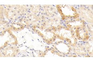 Immunohistochemistry (IHC) image for anti-CD40 Ligand (CD40LG) (AA 1-261) antibody (ABIN7442618)