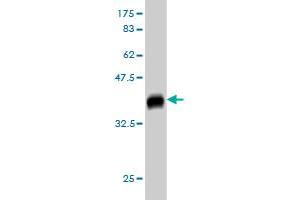 Western Blot detection against Immunogen (37. (GUCY2D antibody  (AA 521-630))