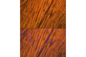 Immunofluorescence analysis of rat heart using  Rabbit mAb (ABIN7265397) at dilution of 1:100 (40x lens). (ACTN2 antibody)