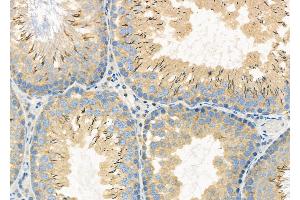 ABIN6261581 and ABIN6272294 at 1/100 staining Rat testis tissue by IHC-P. (EPS8-Like 3 antibody  (Internal Region))