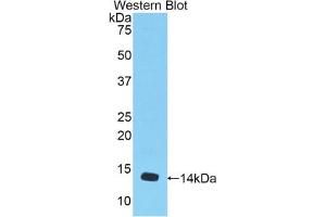 Western blot analysis of the recombinant protein. (MSTN antibody  (AA 268-376))