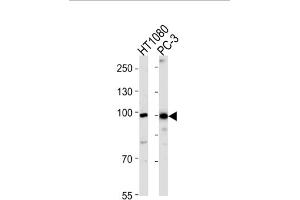 Western Blotting (WB) image for anti-Zinc Finger Protein 560 (ZNF560) antibody (ABIN3004763)