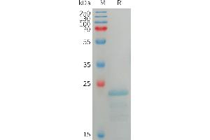 Sperm Autoantigenic Protein 17 (SPA17) (AA 1-151) protein (His tag)