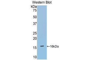 Western Blotting (WB) image for anti-Debranching Enzyme Homolog 1 (DBR1) (AA 133-241) antibody (ABIN1858612) (DBR1 antibody  (AA 133-241))