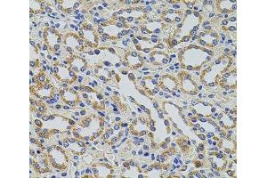 Immunohistochemistry of paraffin-embedded Rat kidney using TRMT2A Polyclonal Antibody at dilution of 1:100 (40x lens). (TRMT2A antibody)