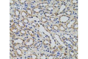 Immunohistochemistry of paraffin-embedded Rat kidney using TRMT2A Polyclonal Antibody at dilution of 1:100 (40x lens).