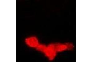 Immunofluorescent analysis of EEF1A1 staining in Hela cells. (eEF1A1 antibody)