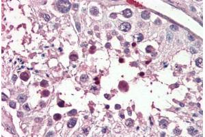 Human Testis (formalin-fixed, paraffin-embedded) stained with PIAS2 antibody ABIN461934 at 3. (PIAS2 antibody  (AA 431-445))