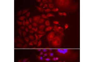 Immunofluorescence analysis of U2OS cells using TRAPPC10 Polyclonal Antibody (TRAPPC10 antibody)