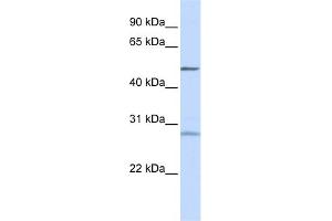 WB Suggested Anti-ZNF141 Antibody Titration:  0. (ZNF141 antibody  (N-Term))