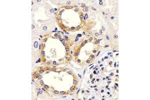 staining EGF in Human kidney tissue sections by Immunohistochemistry (IHC-P - paraformaldehyde-fixed, paraffin-embedded sections). (EGF antibody  (Center))