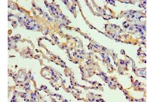 Immunohistochemistry of paraffin-embedded human lung tissue using ABIN7149252 at dilution of 1:100 (CYP2F1 antibody  (AA 100-290))