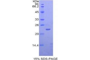 SDS-PAGE analysis of Human SIGLEC12 Protein. (SIGLEC12 Protein)